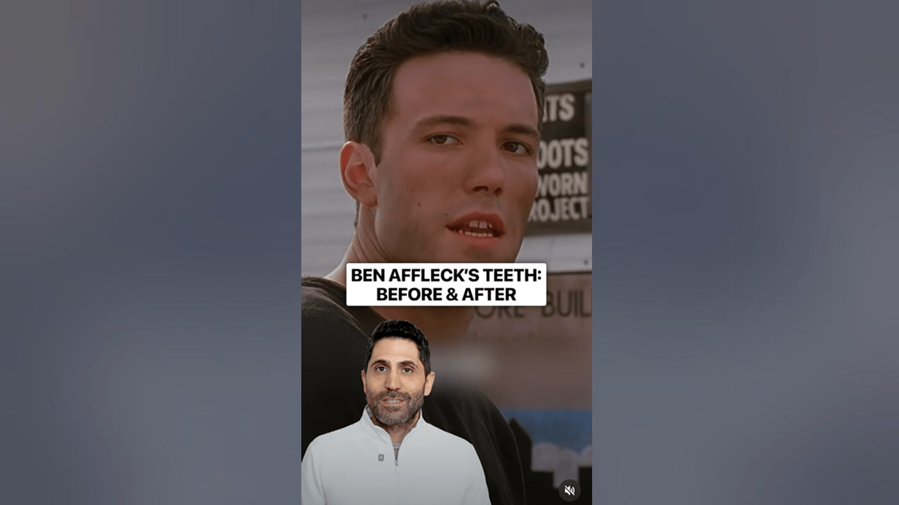 Video title
