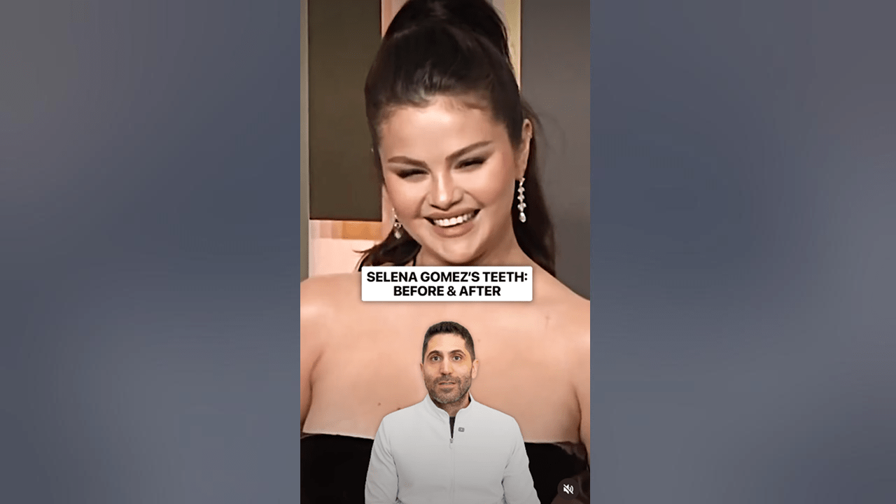 Video title
